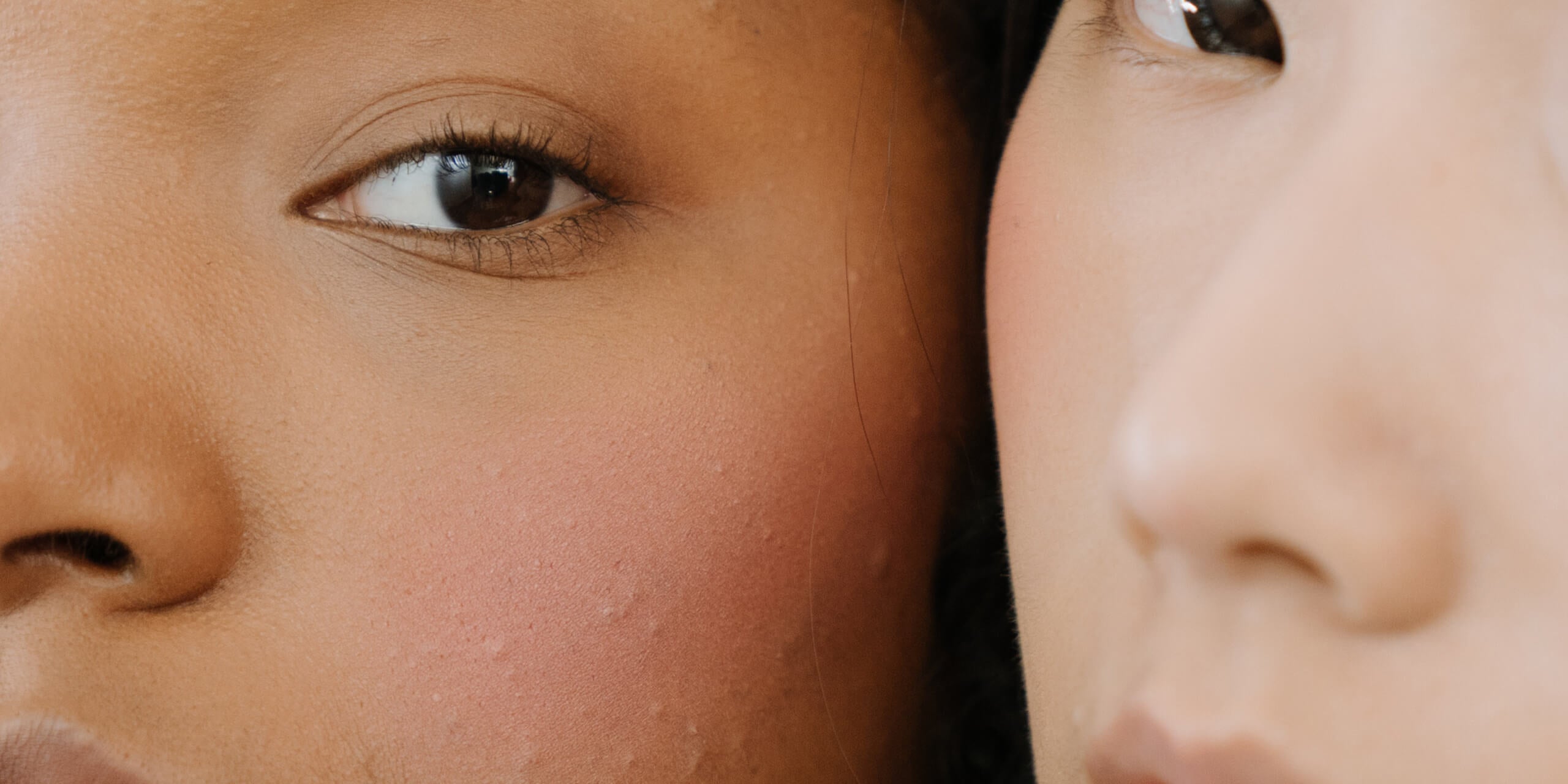 Come eliminare i punti neri